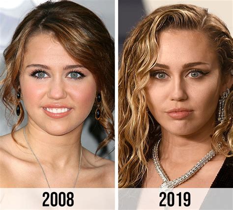 miley cyrus before and after plastic surgery|miley cyrus body now.